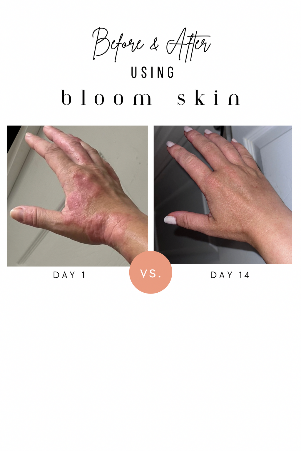 Multipurpose Balm | Ultra Rich