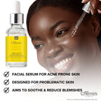 Acne Prone Serum Salicylic Acid 2%, Centella Asistica 3% 30ml