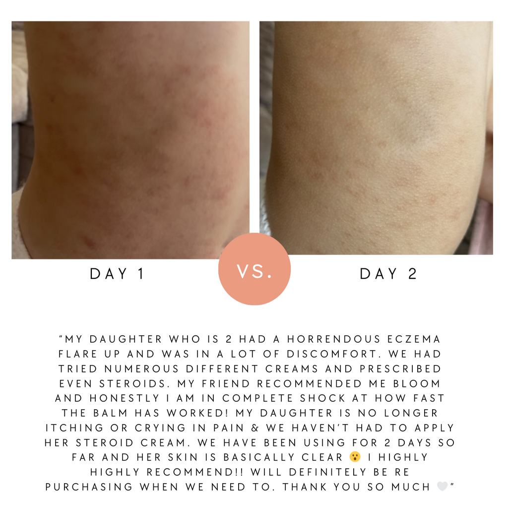 Hydrate & Calm Balm (was Baby & Child Balm)
