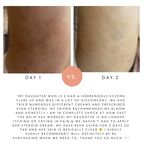 Hydrate & Calm Balm (was Baby & Child Balm)
