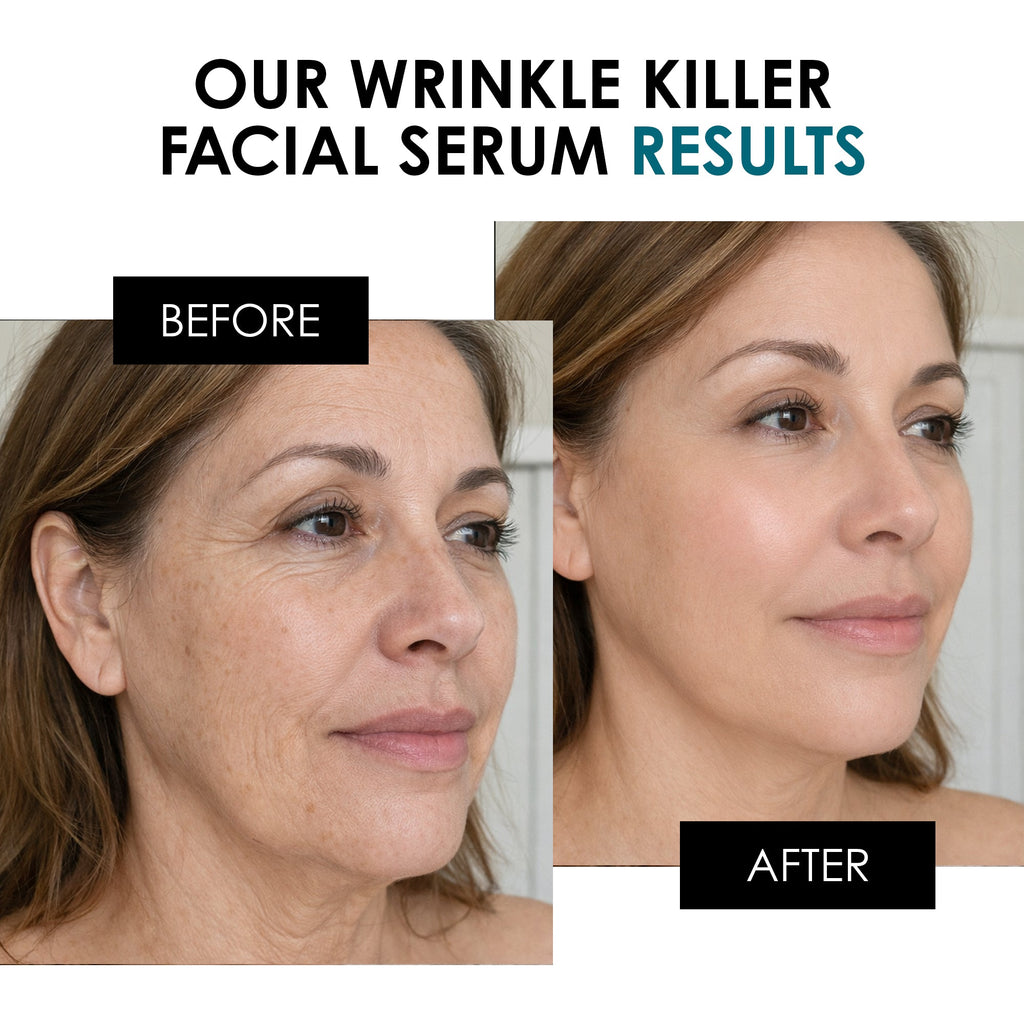 Wrinkle Killer Facial Serum 30ml