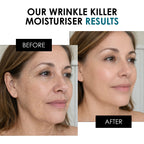 Wrinkle Killer Day Moisturiser 50ml