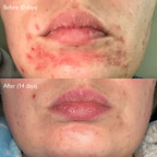 Super Seed - Hemp Seed Face Oil